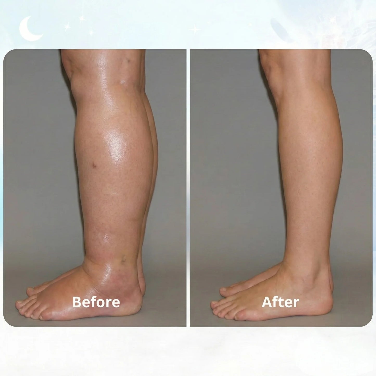 Scalpura - EMS FIX SWOLLEN LEGS FROM HOME