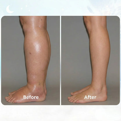 Scalpura - EMS FIX SWOLLEN LEGS FROM HOME